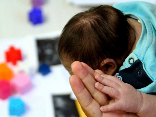 SAÚDE INCORPORA NOVO MEDICAMENTO PARA PACIENTES COM MICROCEFALIA