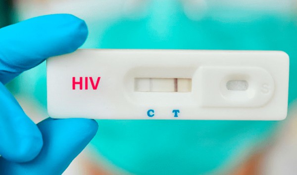 Causas relacionadas à aids mata uma pessoa por minuto no mundo