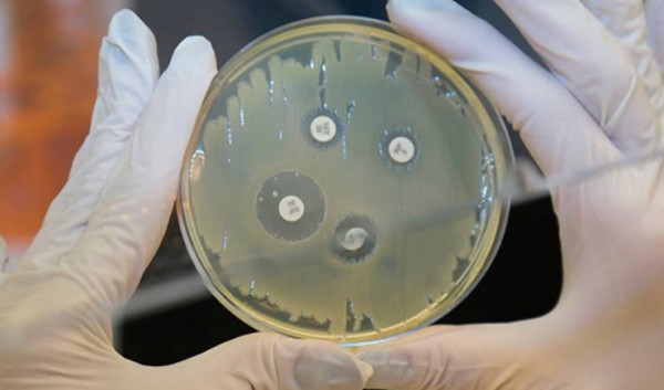 Pesquisadores da USP descobrem que vírus pode revolucionar tratamento contra infecções hospitalares