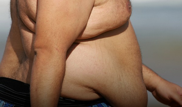 Mais de 1 bilhão de pessoas são obesas no mundo