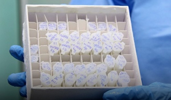 Fiocruz cria insumo 100% nacional para uso no teste rápido da leishmaniose