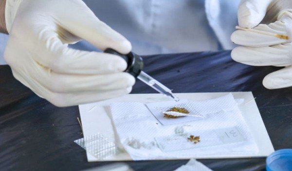 Análises Clínicas: Comitê da ABNT NBR aprova novas normas para exames parasitológicos de fezes