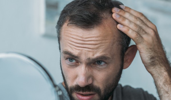 Fim da calvície? Cientista desenvolve produto que apresentou 100% de eficácia para queda de cabelo