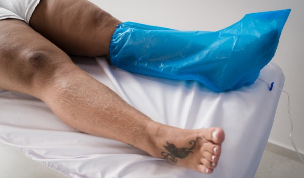 É Lei: Ozonioterapia pode ser realizada no Brasil, incluindo por farmacêuticos